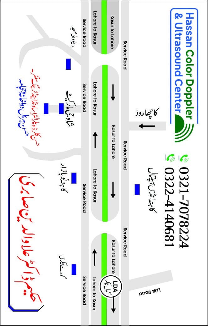 Map of Hassan Color Doppler & Ultrasound Center - Kahna Nau, Lahore