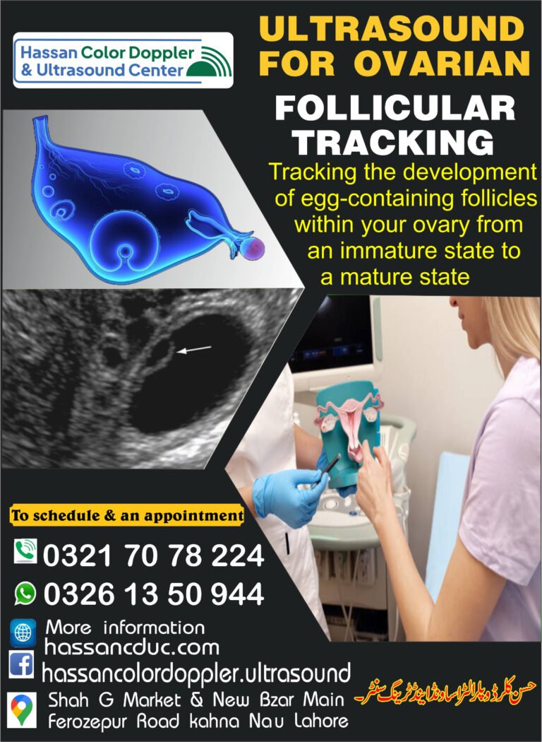 Ultrasound for Ovarian Follicular Tracking - Hassan Color Doppler & Ultrasound Center - Kahna Nau, Lahore
