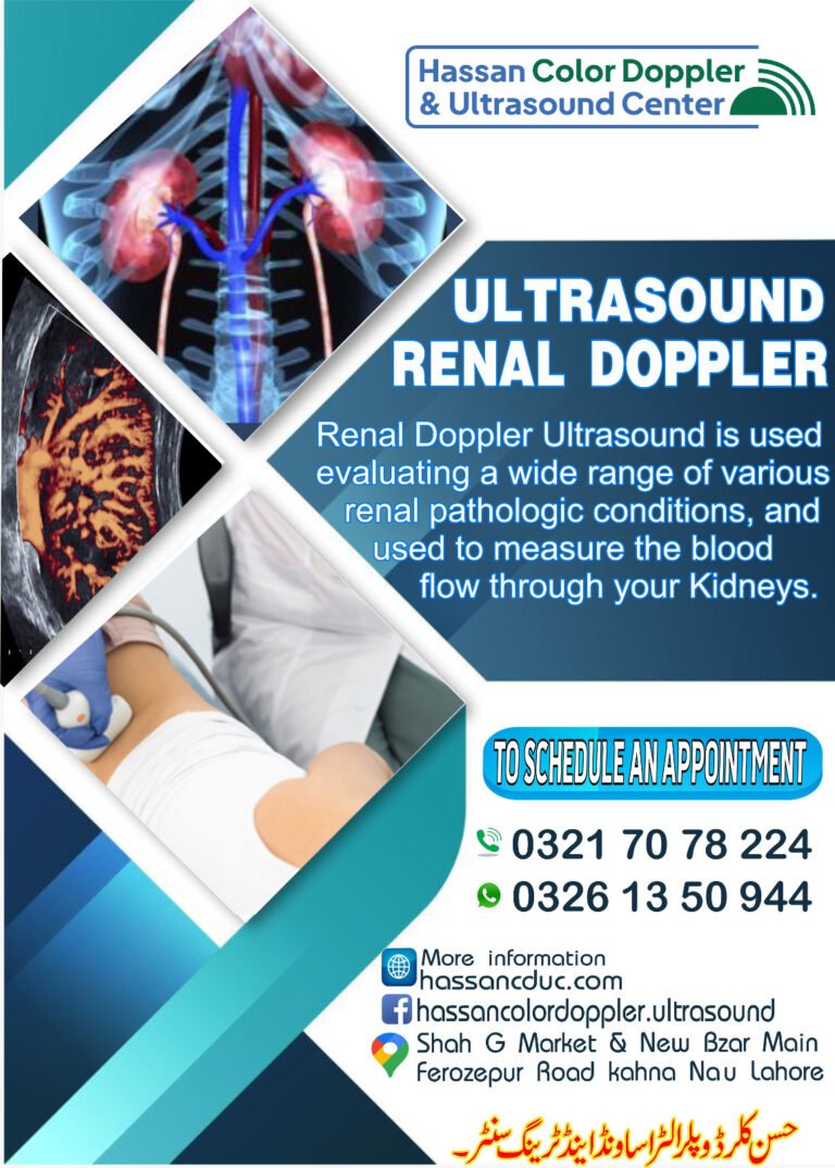 Ultrasound Renal Doppler - - Hassan Color Doppler & Ultrasound Center - Kahna Nau, Lahore